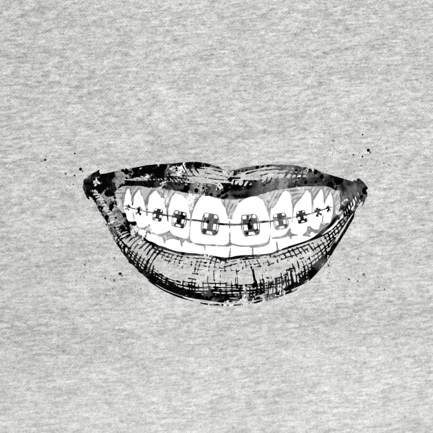 Teeth braces by erzebeth